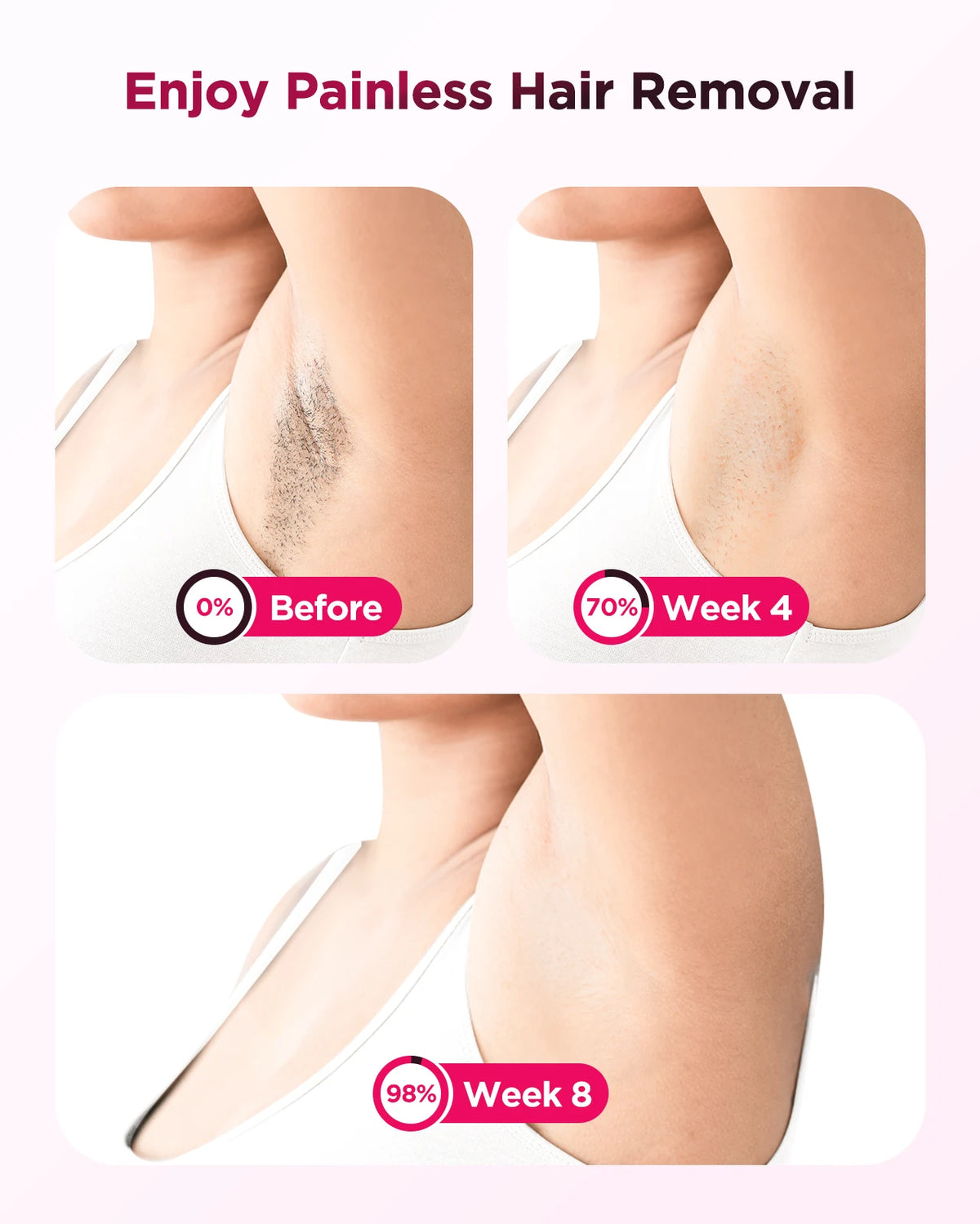 Laser Epilator  Permanent Painless  Hair Remover Machine